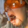 Dental prophylaxis