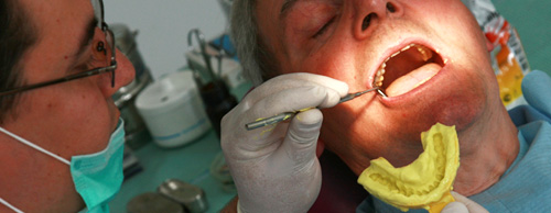 Dental Implant