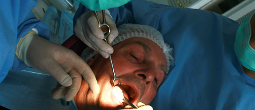 Dental Implant