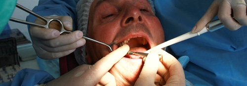Dental Implant